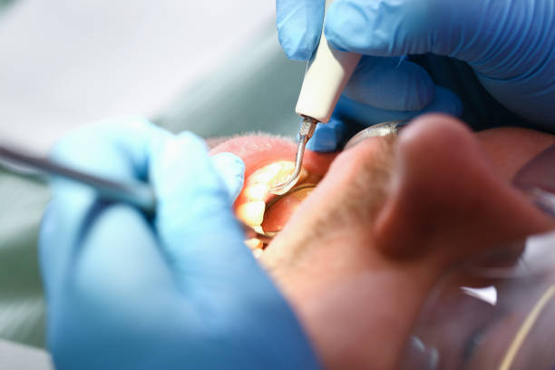 Best Emergency Care for Gum Disease in Clifton, TN